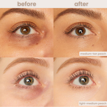 Solutiover Colored clay CC undereye corrector
