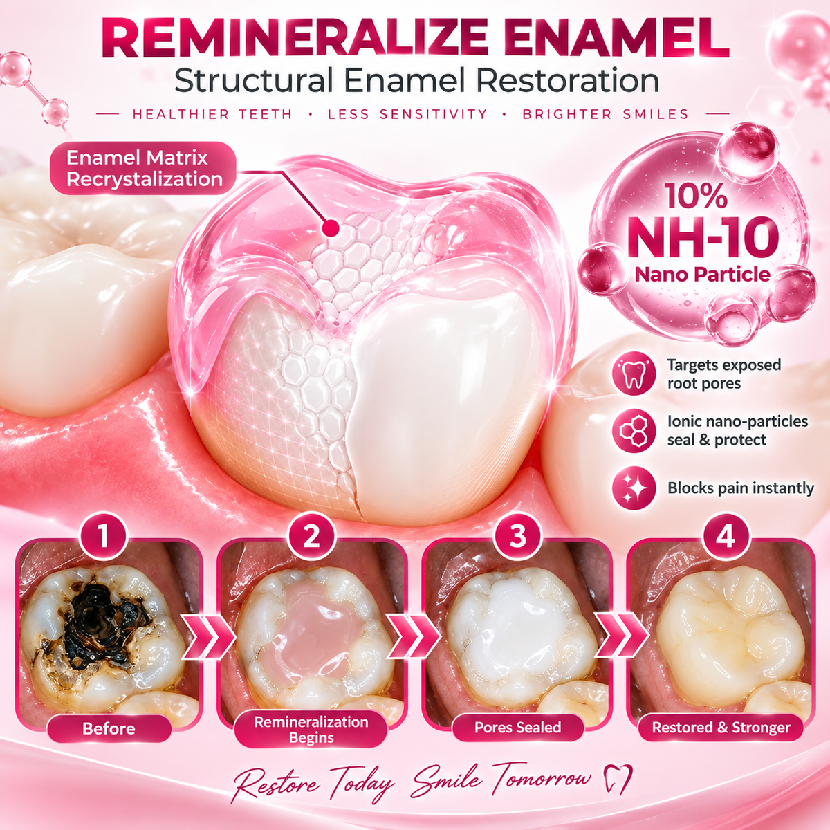 Solutiover® DenPerm Enamel Repair Gel – Helps Strengthen Enamel & Reduce Tooth Sensitivity