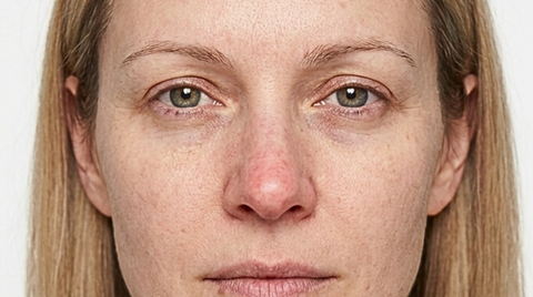 Before foundation application