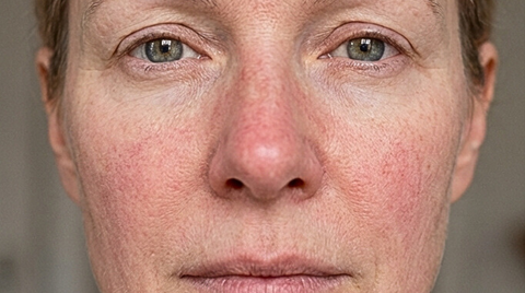Before foundation application