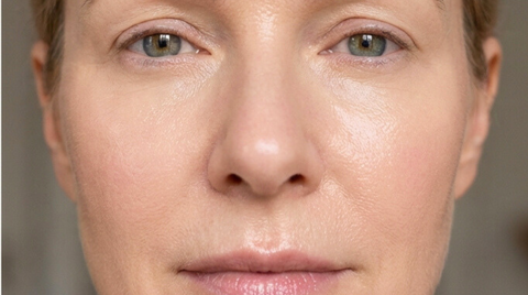 After foundation application
